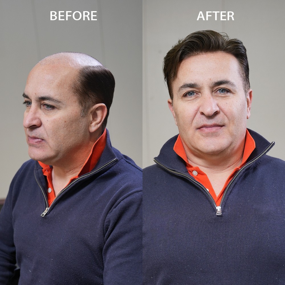 Mens Toupee Hairpiece Fine Mono Hair System Replacement Poly Skin Around Men Wig