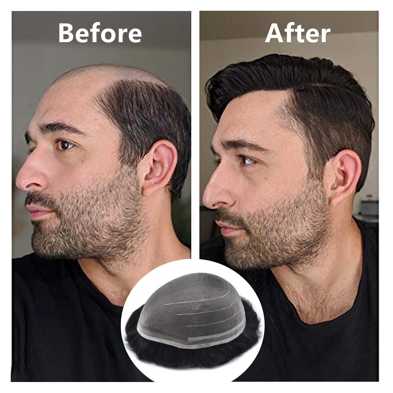 Men’s Toupee Lace Hair System – Fine Welded Lace – 2# DARKEST BROWN 100% Density