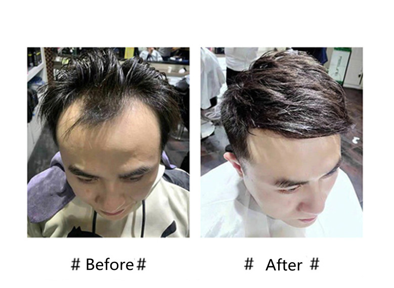 Front Men Toupee 100% Human Hair Piece Man Front Toupee Natural Hairline