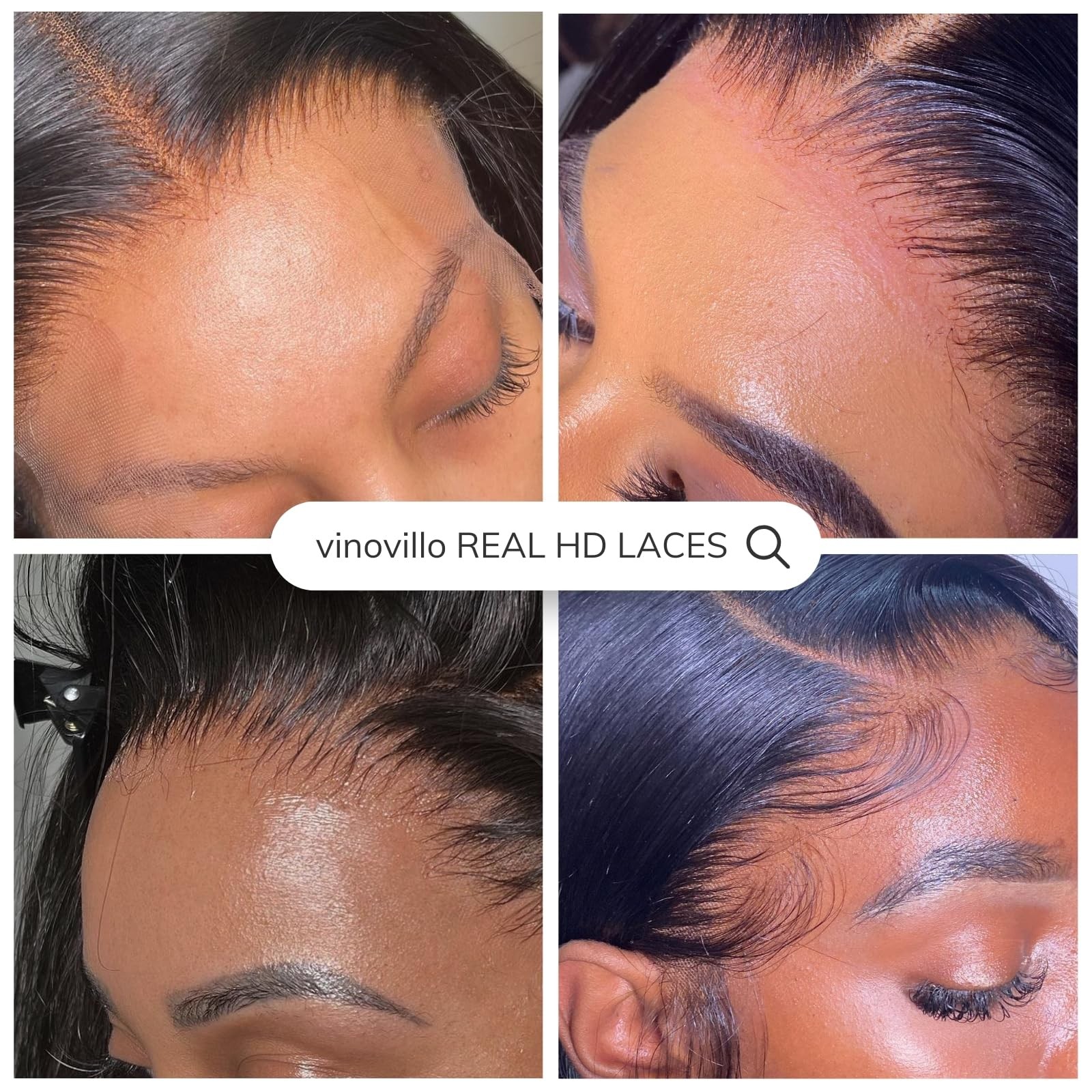 Vinovillo 6X6 Skinlike Real Hd Lace Closure Only Body Wave Ultra Thin Invisible