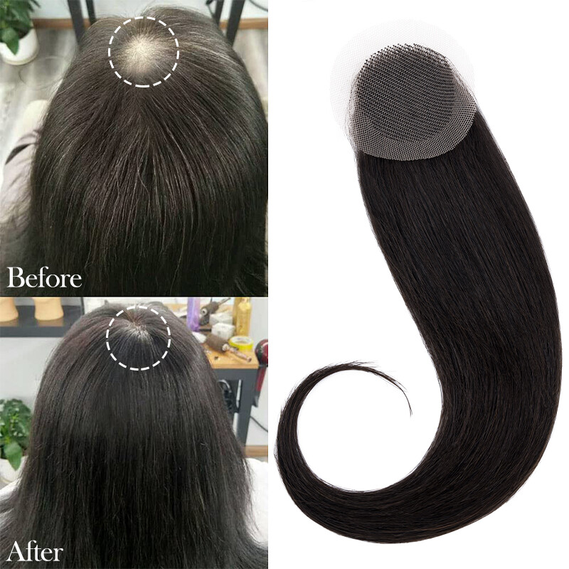 100% Human Hair Patch, Full Thin Skin Base Cover-up One Pieces for Hair Loss