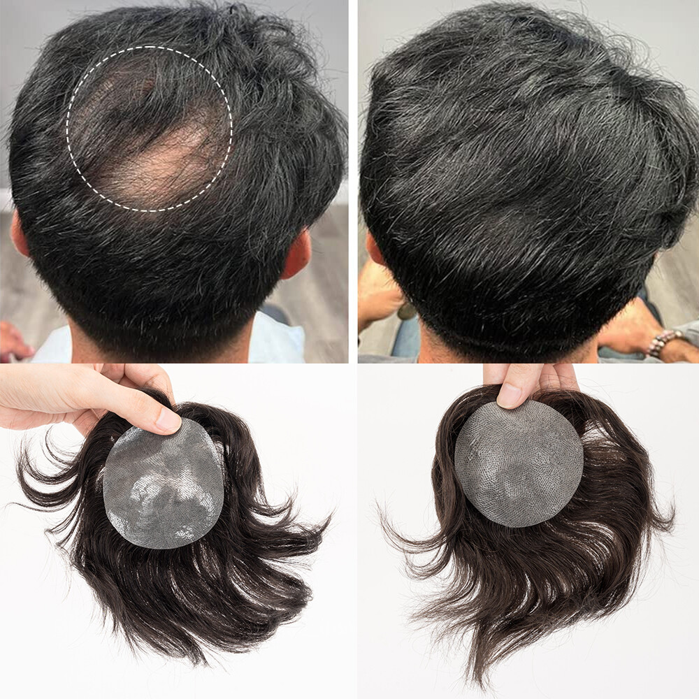 Bald Spot Hair Patch Toupee for Men Full PU Skin Base Cover-up Hair Patche Piece