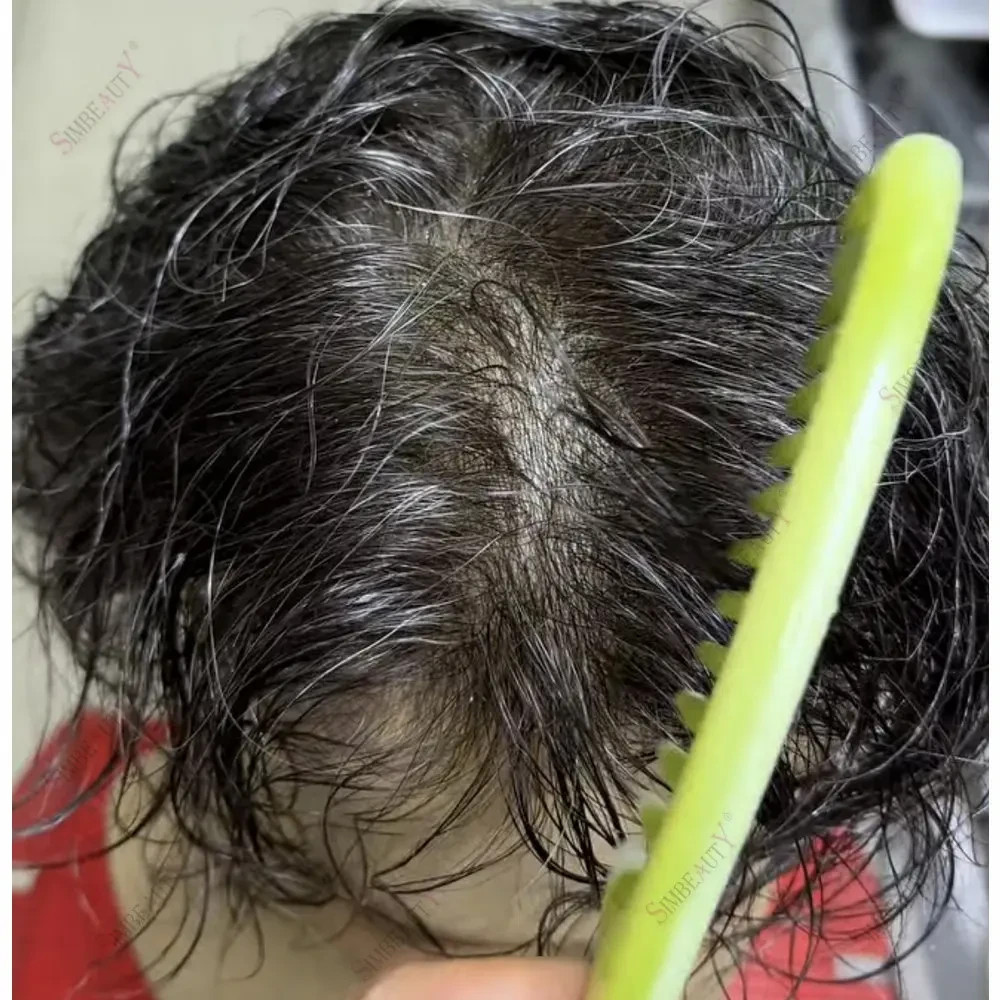 Super Natural Hairline 80Density 0.02mm Ultra Thin Skin Undetectable Vloop Men