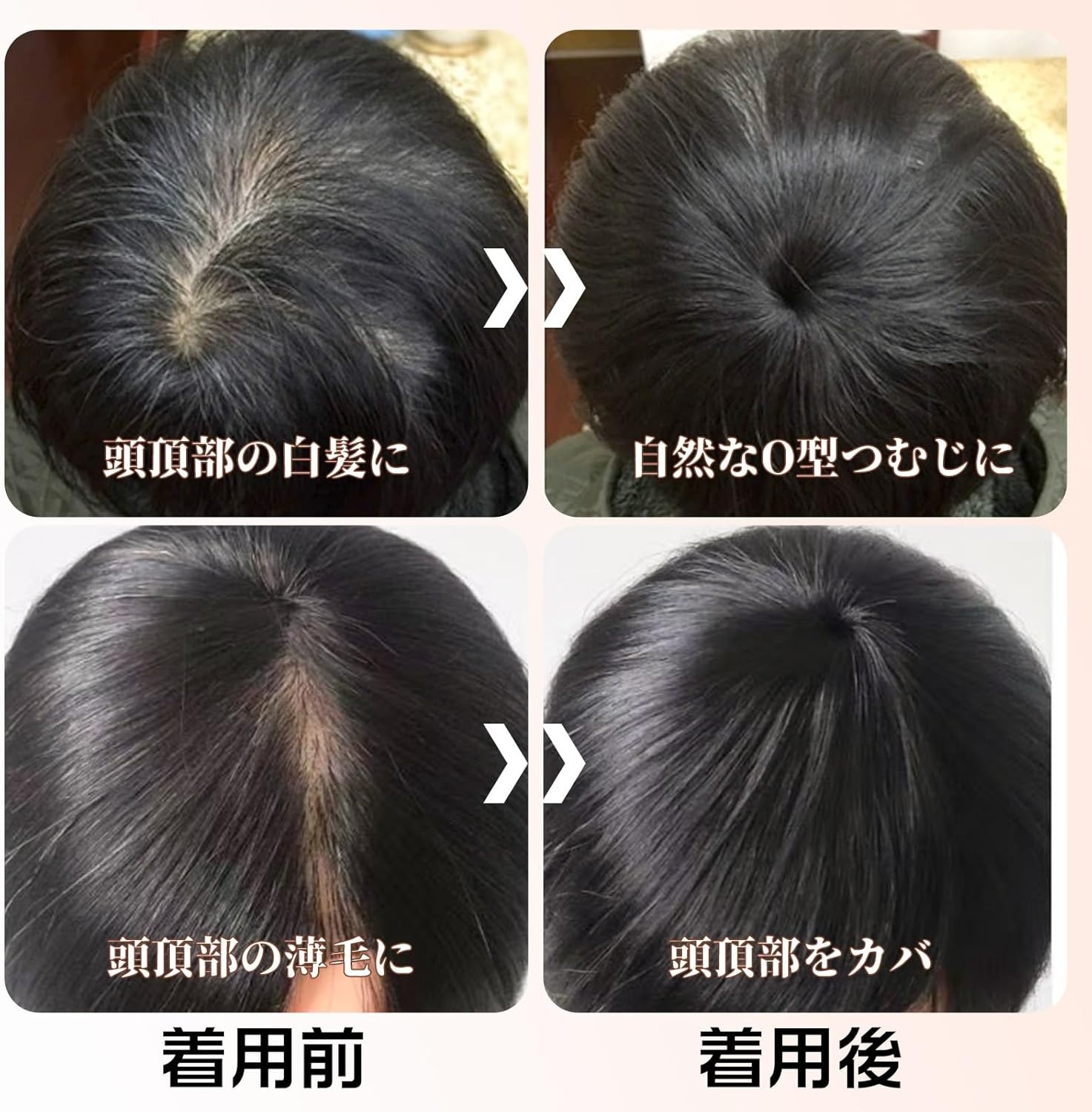 Silk Base Straight Clip In Human Hair Toppers For Loss Thin Hair Replacement