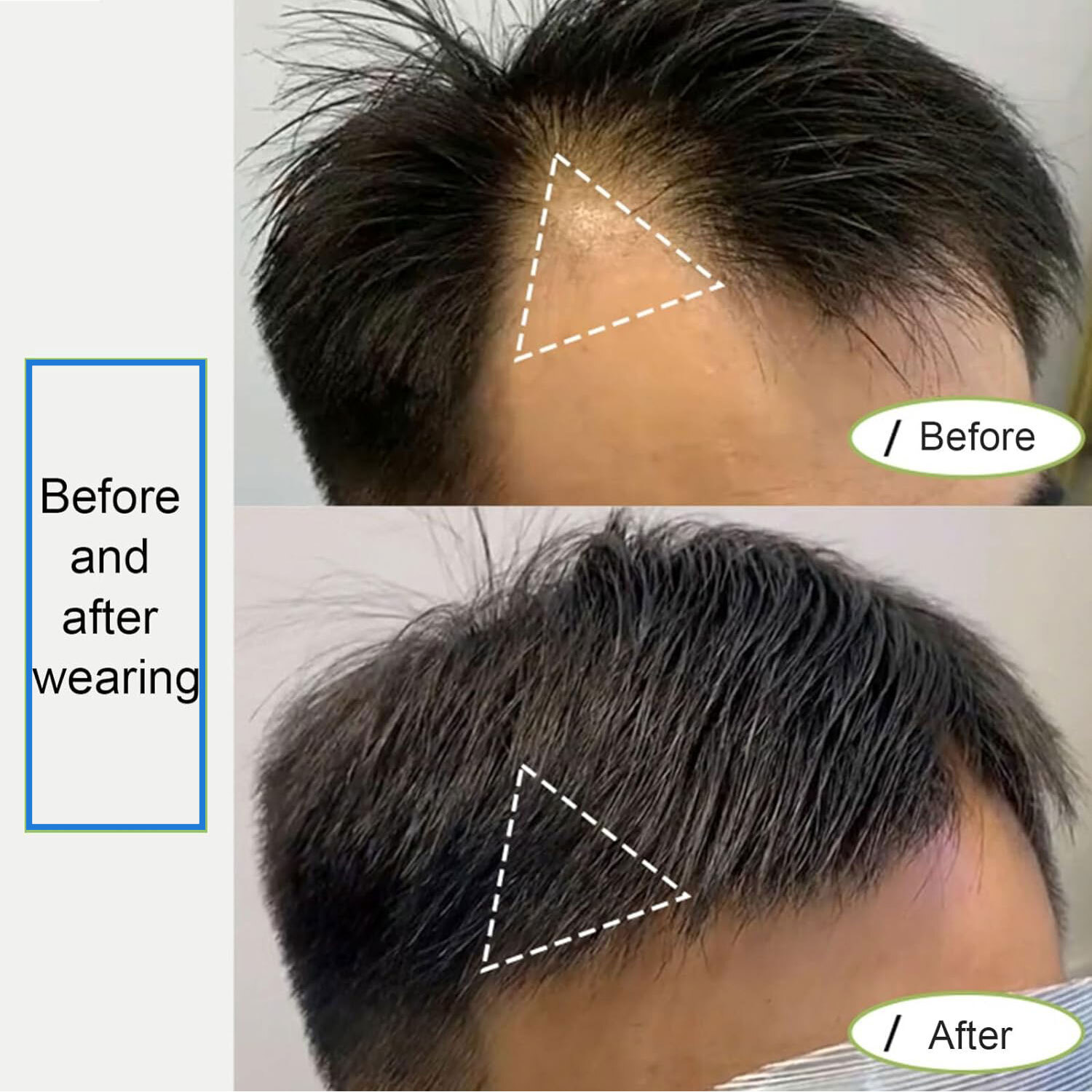 Front Hairline 100% Human Hair Patch Full Skin Base Cover-Up Topper Piece Toupee