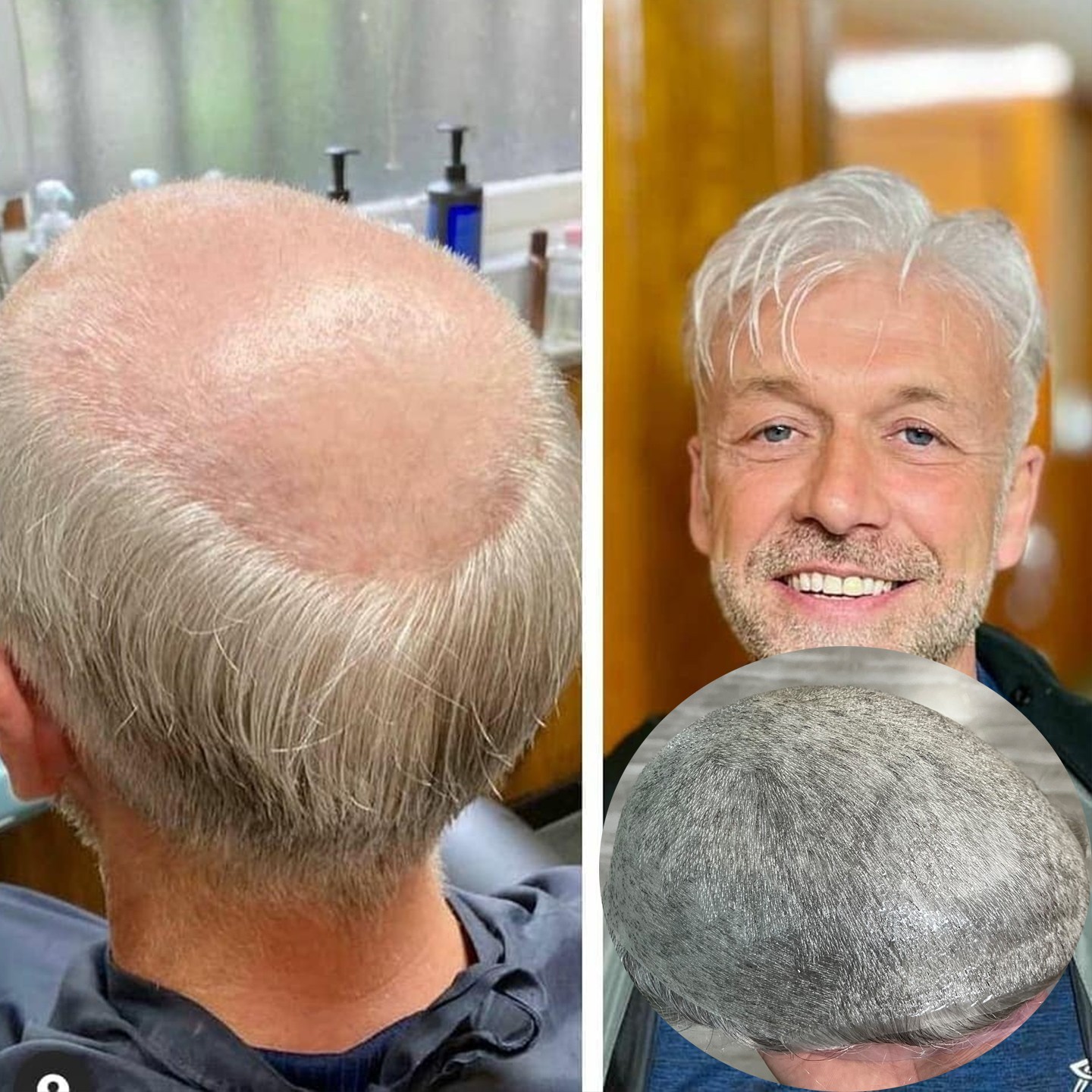 Ultra thin skin Toupee Men Hair Replacement pieces with Natural Hairline Units