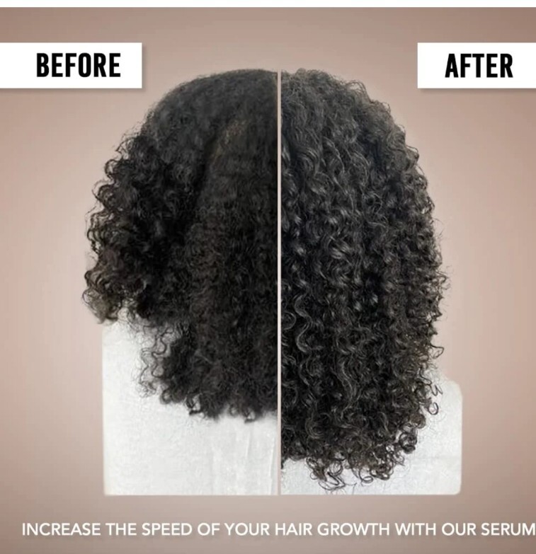 1 NIB Amyla Cosmetic Hair Growth Serum & 1 New Hair Growth Spray Oil