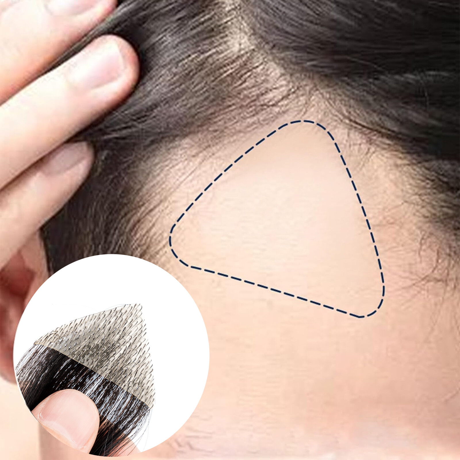Men Frontal Hairline Temple Hair Patch Remy Human Hair Cover up Topper Bald Spot