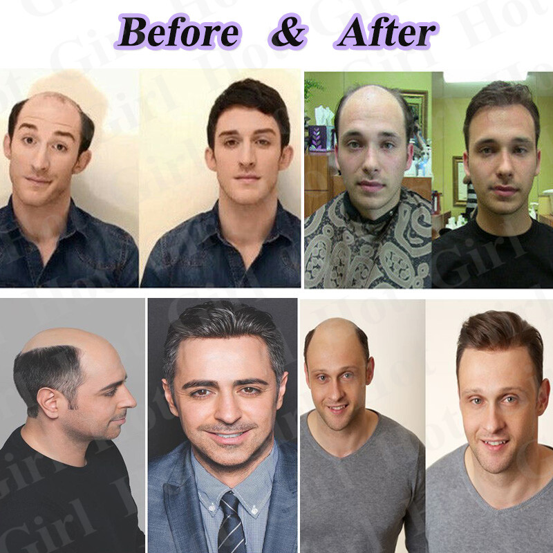 US French Lace Toupee Hair Mens Hairpiece 100% Human Hair Replacement System #1B