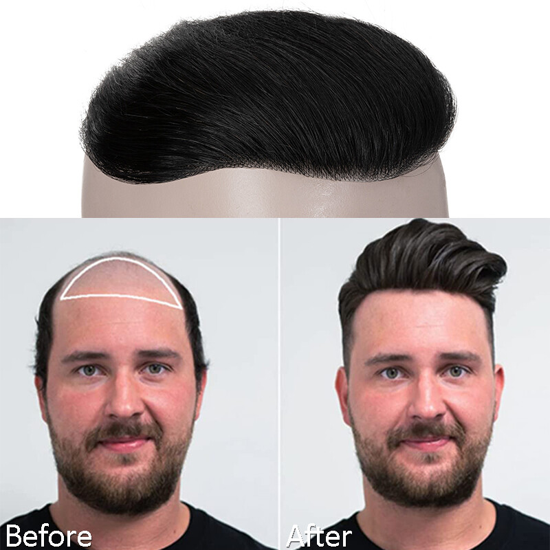 Men Forehead Hairline Toupee 100%Human Hair Skin PU Man Hairpiece Frontal Topper