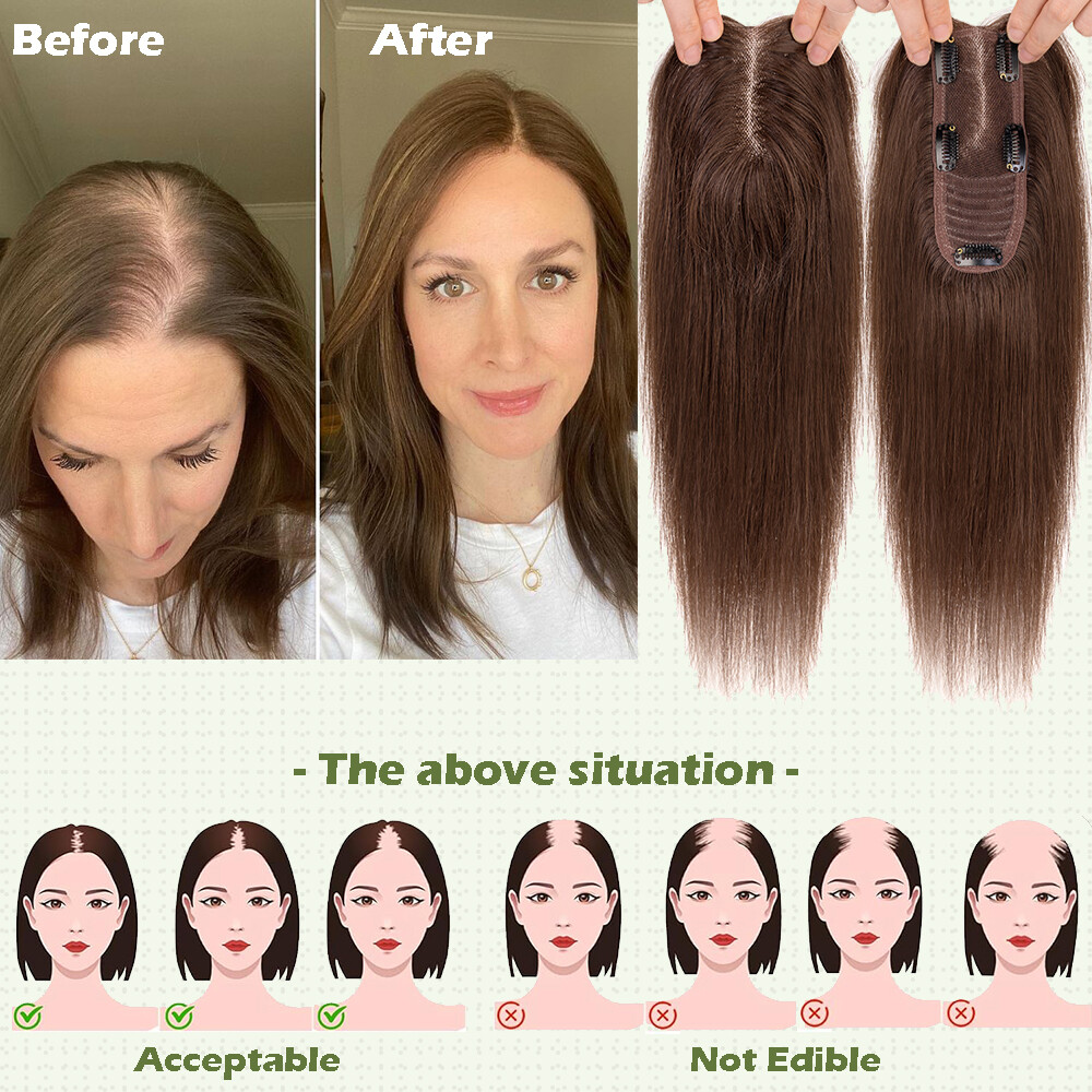 Women Topper Clip in Remy Human Hair Lace Base Hair Pieces Wide Hairline Part