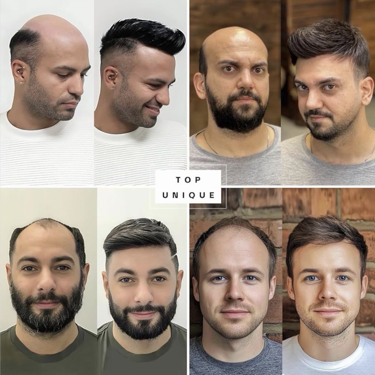 Swiss Lace Front with Thin Skin Back & Side Toupee Hair for Men