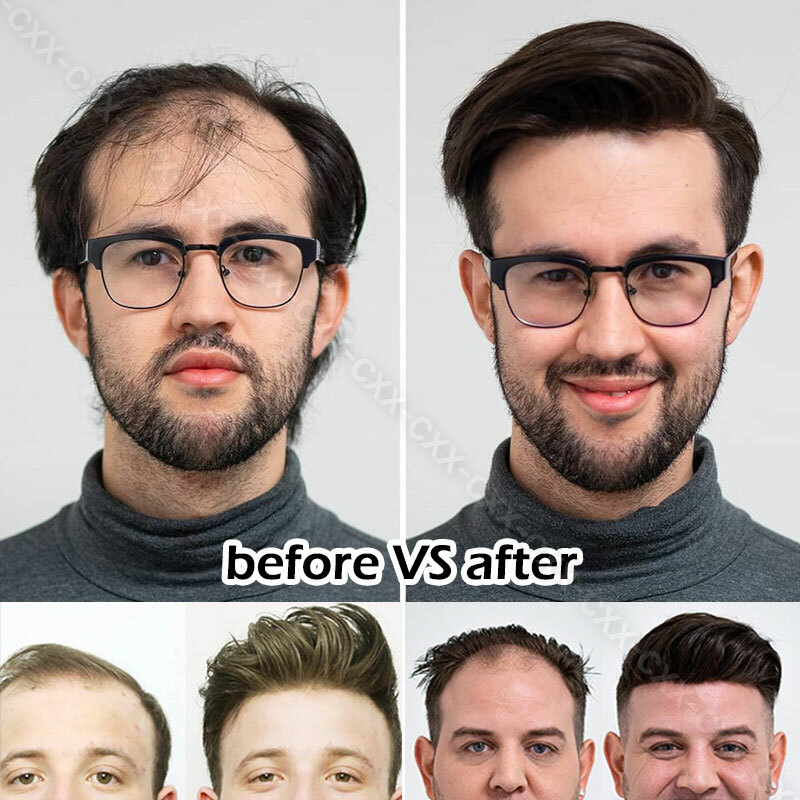 15*7cm Mens Hair Replacement System Ultra Thin Skin Toupee Hairpiece Front Piece