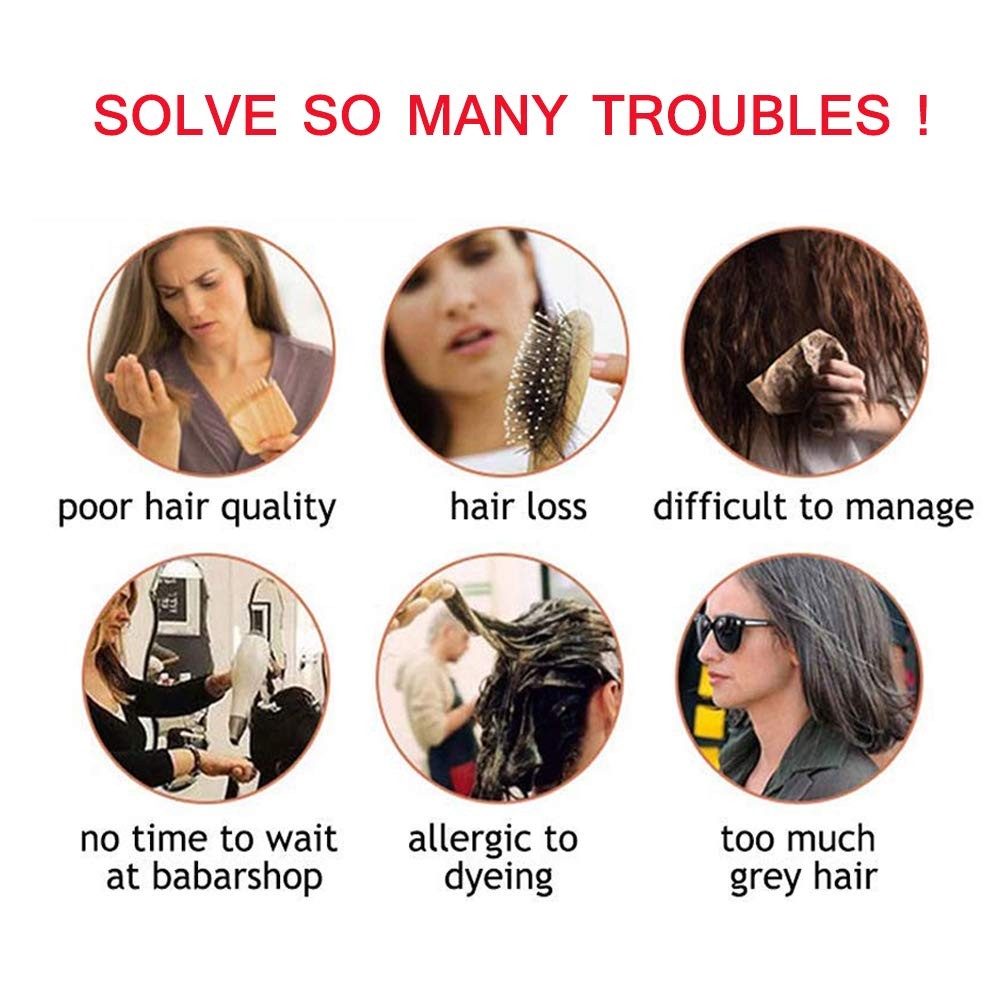 My-Lady Top Hairpieces For Womem Bangs Natural Mono Base Topper 100 Real Human