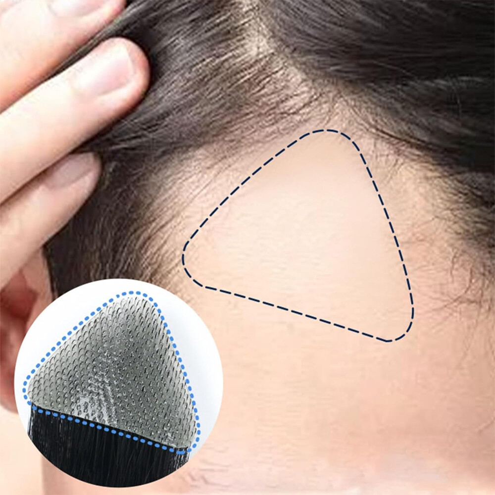 Temple Hair Patches Human Hair Pieces Skin Base Cover-Up Frontal Hairline Toupee